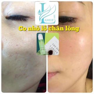 toner tinh thể bạc hà lamer