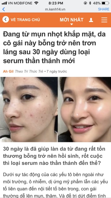 Tinh chất ngừa mụn SOME BY MI AHA BHA PHA MIRACLE SERUM