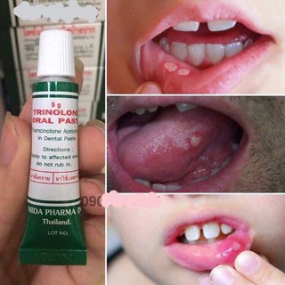 Thuốc nhiệt miệng Thái Lan