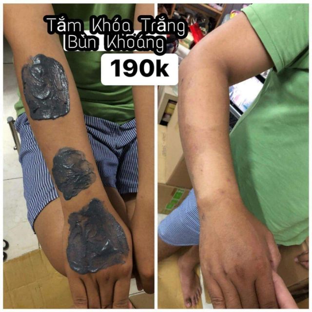 Tắm trắng bùn khoáng NS