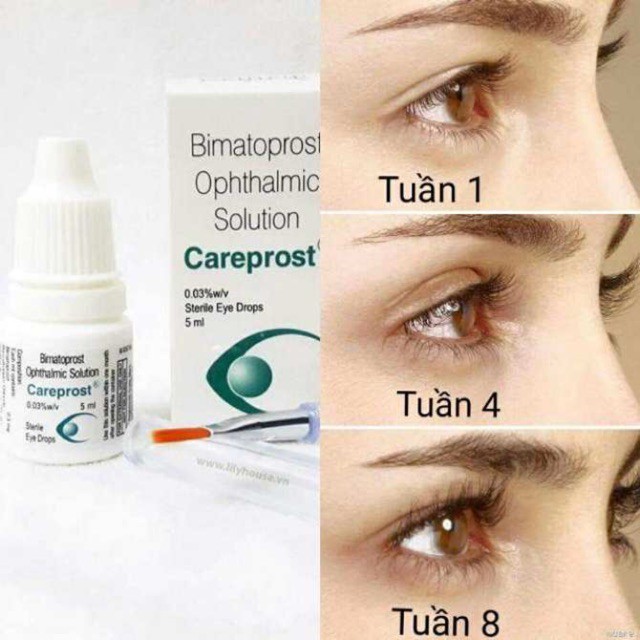 Dưỡng Mi Careprost Hỗ Trợ Mi Mọc Dài Và Dày