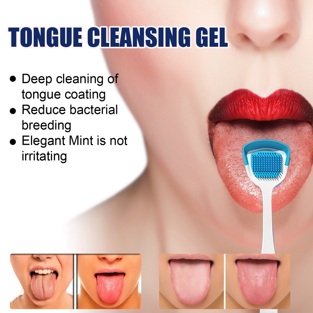 Gel Làm Sạch Lưỡi Eelhoe Loại Bỏ Mùi Hôi Chăm Sóc Răng Miệng