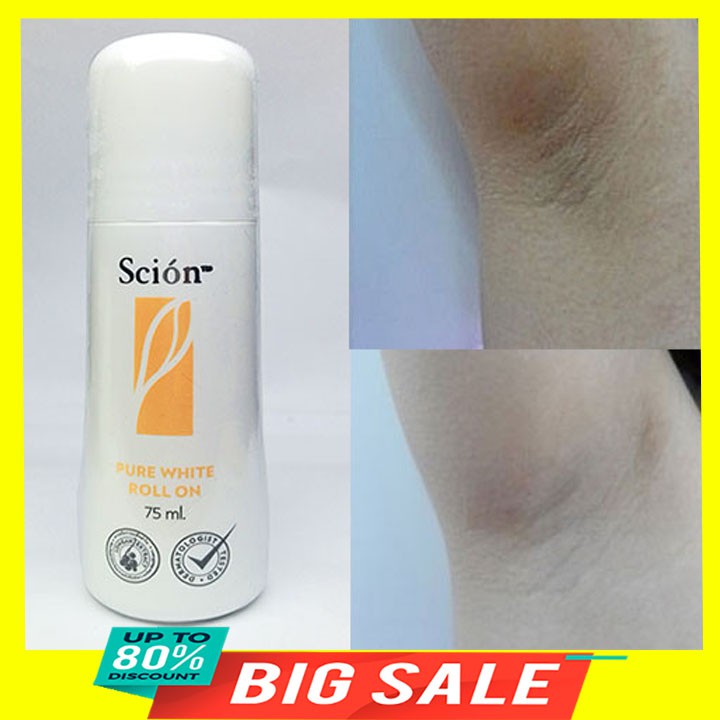Lăn nách khử mùi  75ml