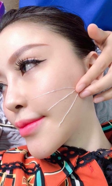 Hộp cấy chỉ kim cương SELINA căng bóng, giảm nếp nhăn