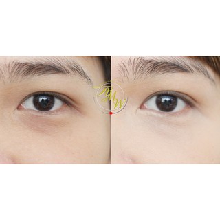 CHE KHUYẾT ĐIỂM fit me