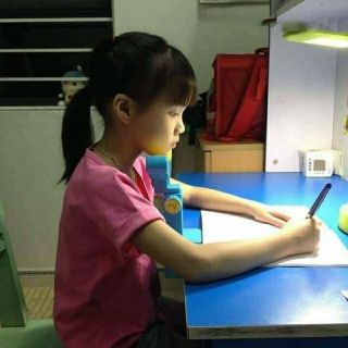 Kẹp chống cận thị cho trẻ