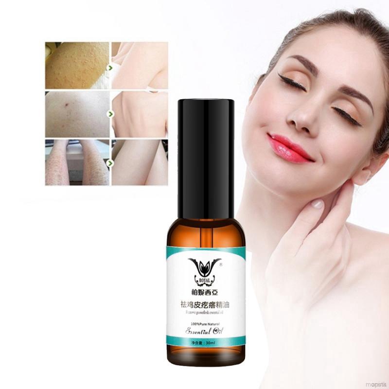 [Hàng mới về] Huyết thanh tinh dầu trị viêm nang lông & nứt chăm sóc da | BigBuy360 - bigbuy360.vn