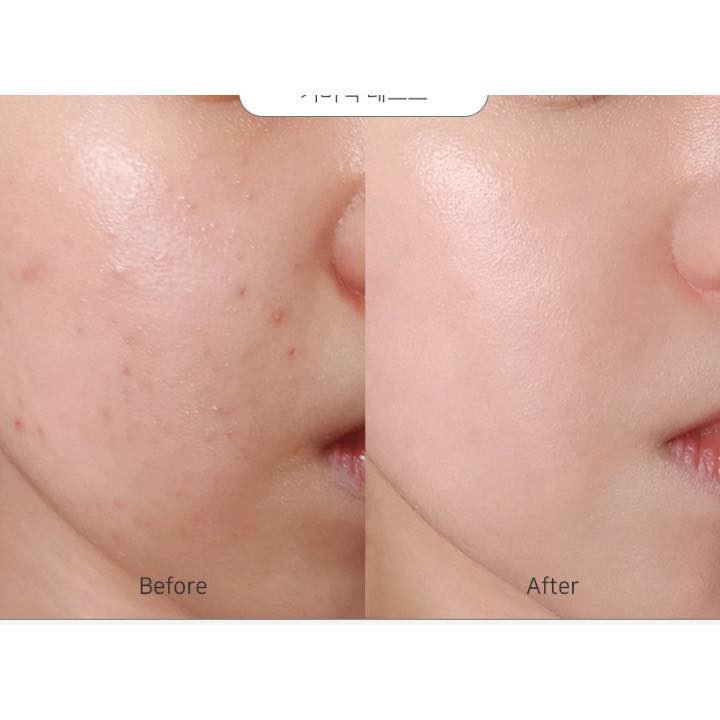 Kem Nền Căng Bóng Enough Collagen Moisture Foundation SPF 15 100ml