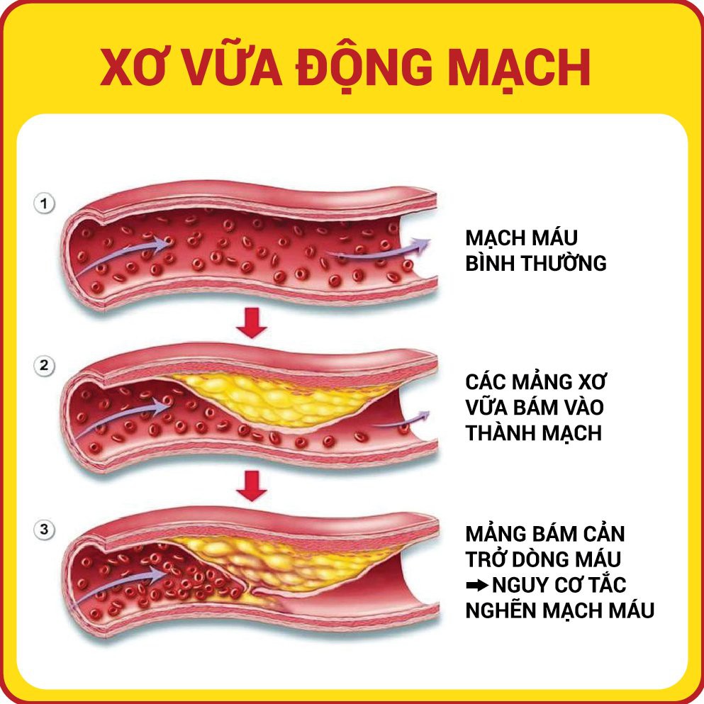 VIÊN DẦU CÁ VITAR FISH OIL 1000MG - HỘP 100 VIÊN - Bổ sung Omega-3, DHA và EPA - TPBVSK | BigBuy360 - bigbuy360.vn