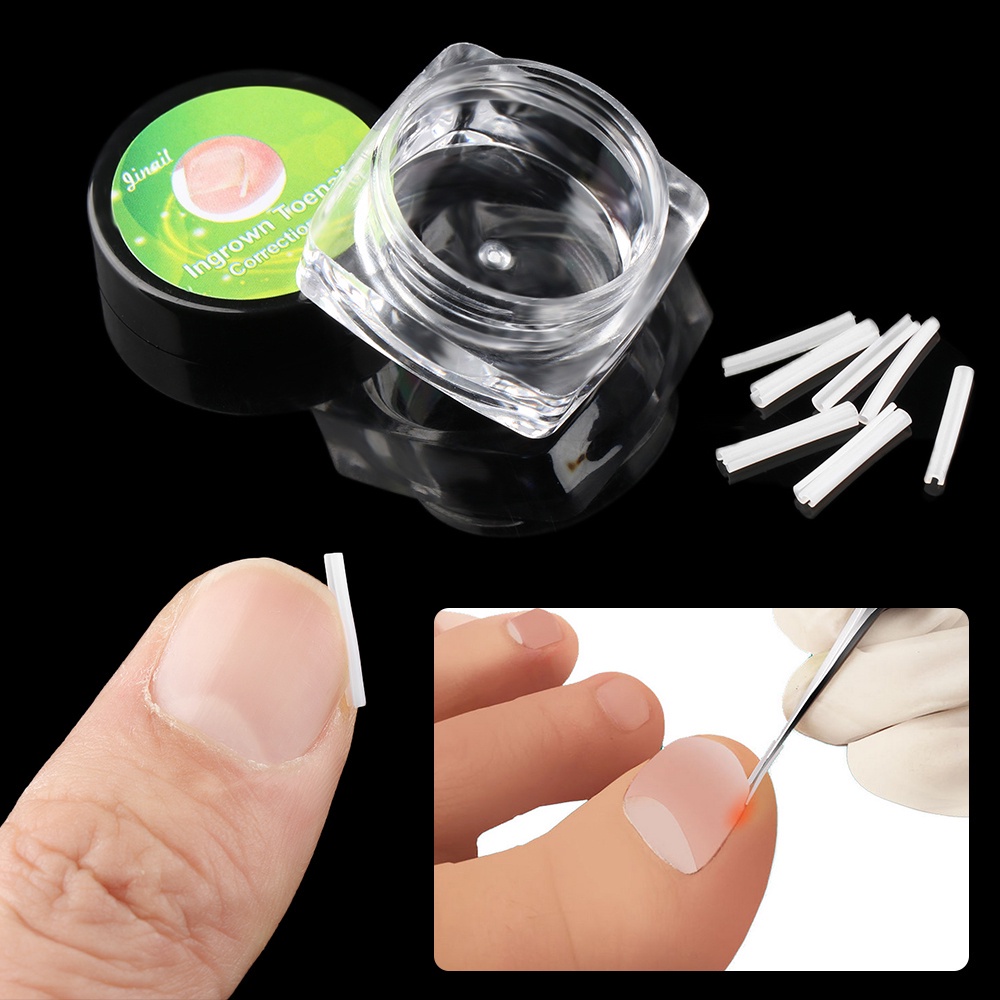 [Hàng mới về] Hộp 10 Kẹp Chỉnh Sửa Làm Thẳng Móng Tay / Móng Chân Chống Dị Ứng