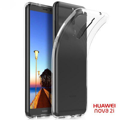 Ốp dẻo trong suốt Huawei Nova 2i / Mate 10 Lite (Hàng loại A)