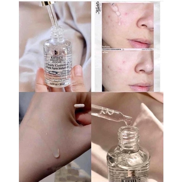 Serum Giảm Thâm Nám Kiehls Clearly Corrective Dark Spot Solution (Kiehl’s)