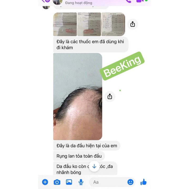 REDENYL - Dầu gội cho đầu tăng tiết bã nhờn, da dầu, nấm đầu, gàu, vảy nến, lang ben, rụng tóc 200ml