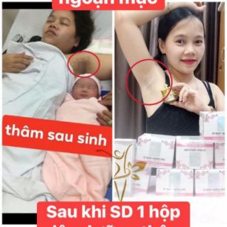 BIHO LADI SIÊU DƯỠNG THÂM 5S ( biho lady loại bỏ thâm khử mùi nách bẹn mông bikini)