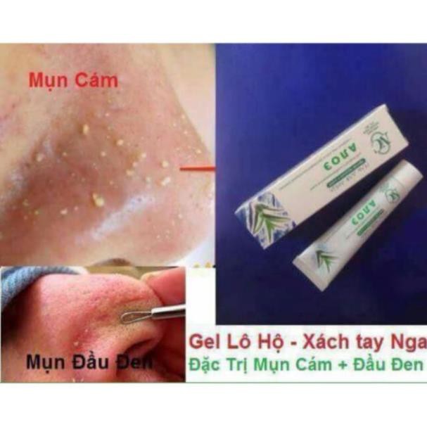 [Đơn 50K FreeShip] GEL LÔ HỘI  - ĐẶC TRỊ mụn, chống viêm [ chính hãng 100% của Nga ] G149 | WebRaoVat - webraovat.net.vn