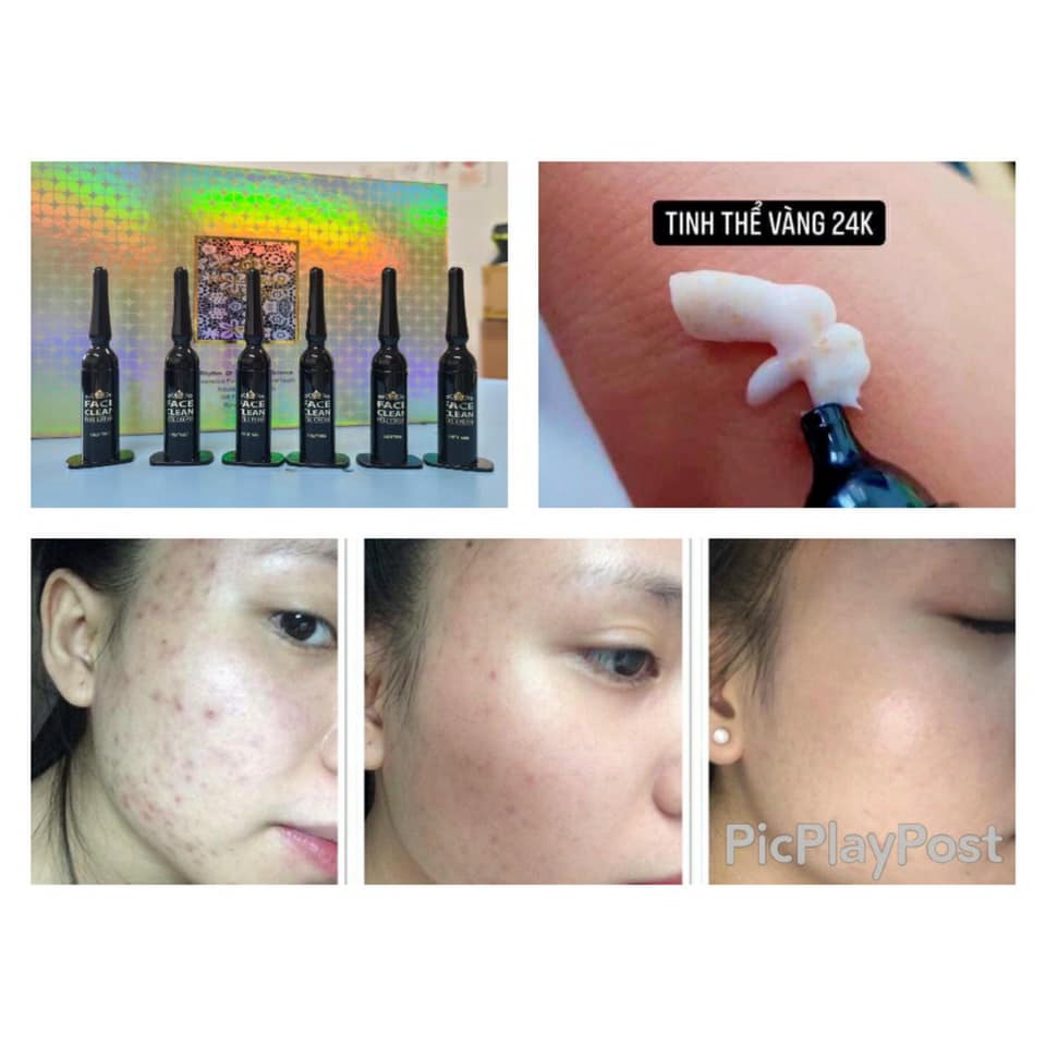 KEM VI GAI TẢO BIỂN VÀNG 24K RONAS 2 GAM