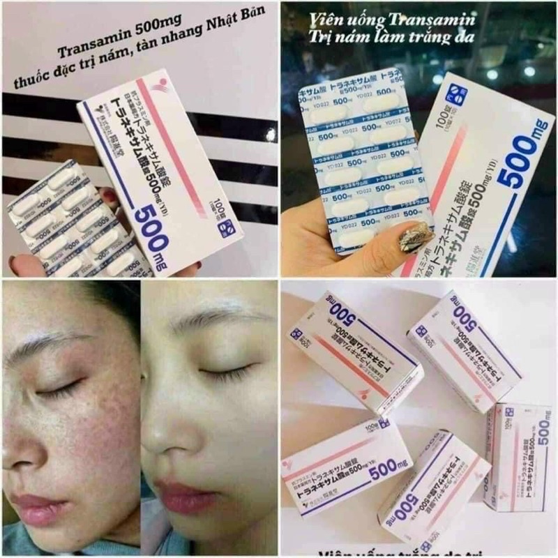 VIÊN UỐNG TRẮNG DA TRANSAMIN 500mg NHẬT BẢN - CHÍNH HÃNG