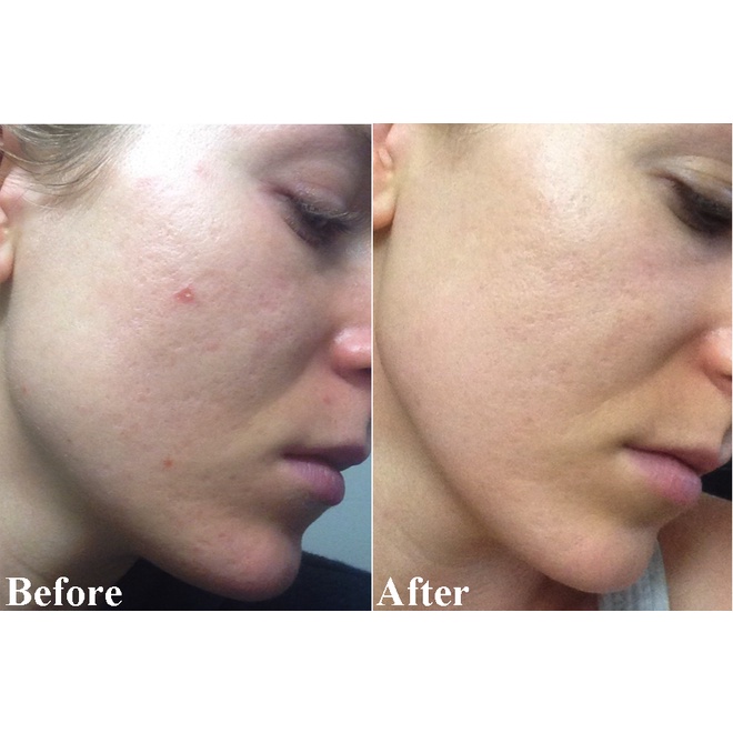 Serum Tinh chất làm sáng và tái tạo Dr.wu Mandelic acid 18% 15ml