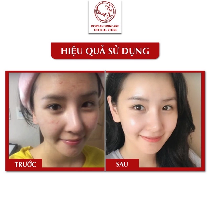 Bộ kem loại bỏ nám Dongsung Premium Skincare Set cải thiện và tăng đề kháng cho da, làm trắng sáng da