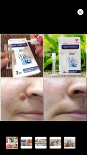 THUỐC TẨY NỐT RUỒI