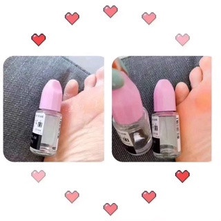 Tinh Chất Giảm Nấm Viêm Da Cơ Địa Zefnart 2%Nước Ăn Chân Tay Mụn Nước,Nấm Móng 10ml Nhật Bản