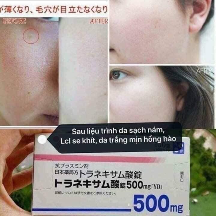 (Chính hãng chuẩn nội địa date mới) Trắng da_Transamin 100v | BigBuy360 - bigbuy360.vn