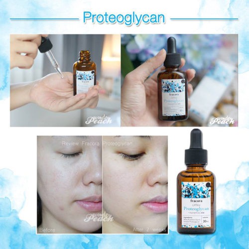 SERUM FRACORA XANH GIÚP TÁI TẠO DA 30ML NỘI ĐỊA NHẬT