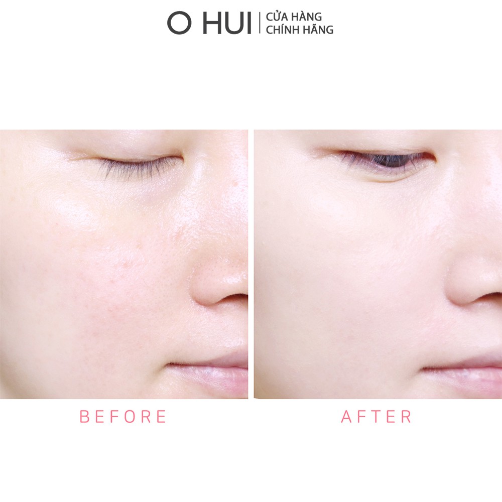 Kem nền dạng thỏi siêu che phủ kiểm soát nhờn OHUI Ultimate Cover Stick Foudation SPF50+/PA +++ 15g | BigBuy360 - bigbuy360.vn