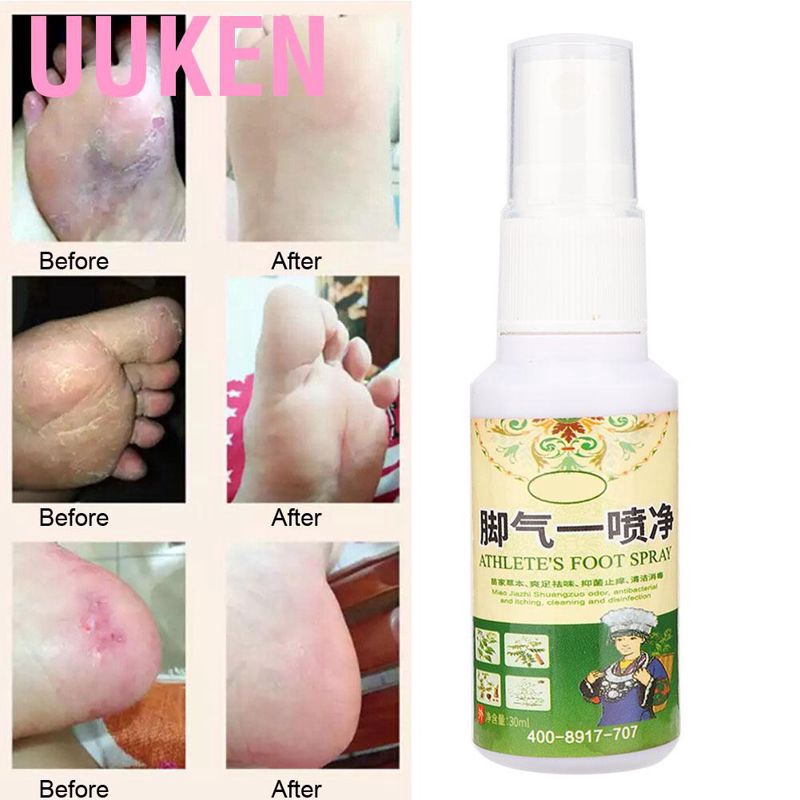 (Hàng Mới Về) Chai Xịt Khử Mùi Hôi Chân Chiết Xuất Thảo Dược 30ml