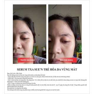 Tinh chất Trẻ hóa da vùng mắt