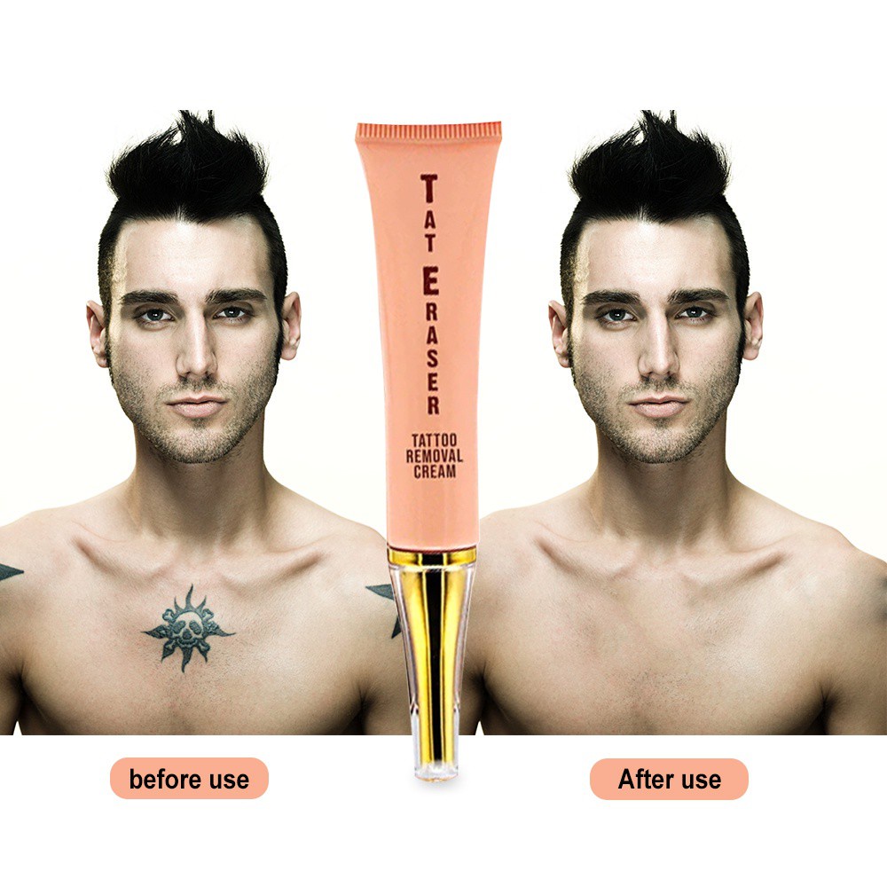 Kem xóa hình xăm vĩnh viễn tự nhiên không gây đau