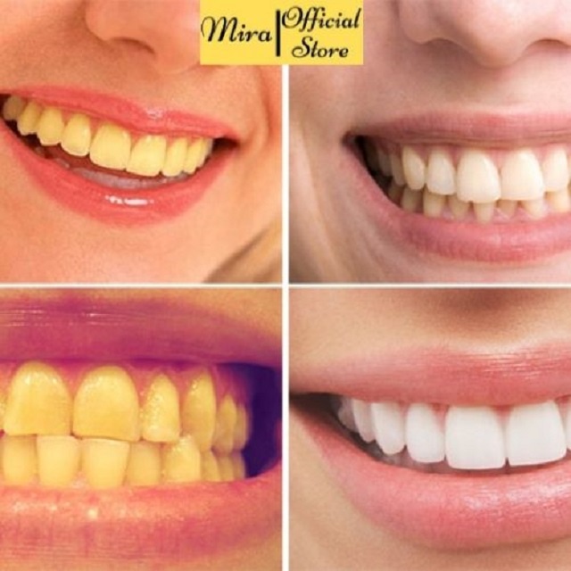 Miếng dán trắng răng tiện lợi 3D White
