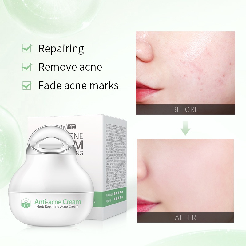 Bộ 2 món mỹ phẩm hỗ trợ cải thiện tình trạng mụn kiểm soát dầu phục hồi da LAIKOU