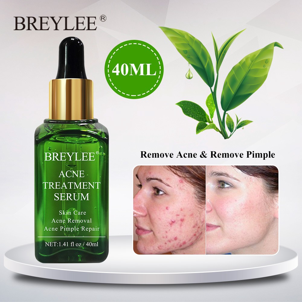 Serum hỗ trợ giảm mụn BREYLEE thể tích 1.41 fl oz / 40ml chất lượng cao