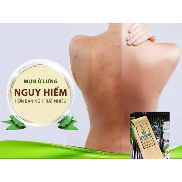 Thảo mộc xông tắm,chăm sóc cơ thể Đông y gia truyền Thông Cát(Since 1918)- Hết mụn lưng, lỗ chân lông trong 2 tuần