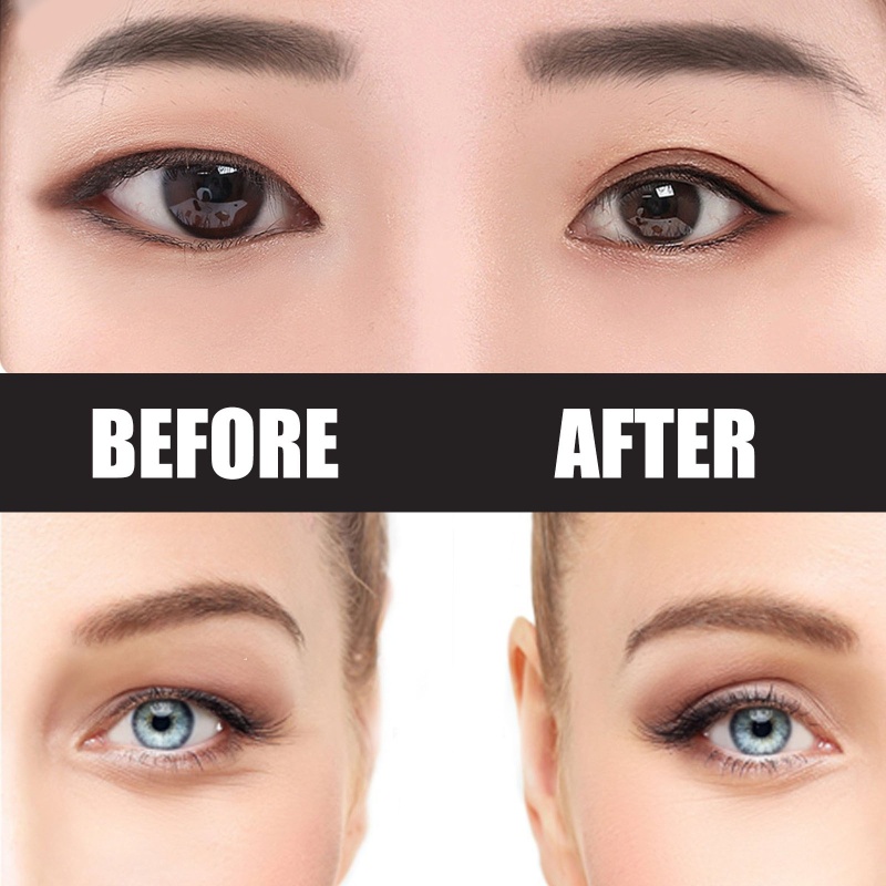 Whi Bộ Miếng Dán Kích Mí Vô Hình Cho Saggy Hood Droopy Uneven Mon