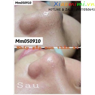 Nhíp gắp mụn đa năng Thần Thánh [Hàn Quốc]