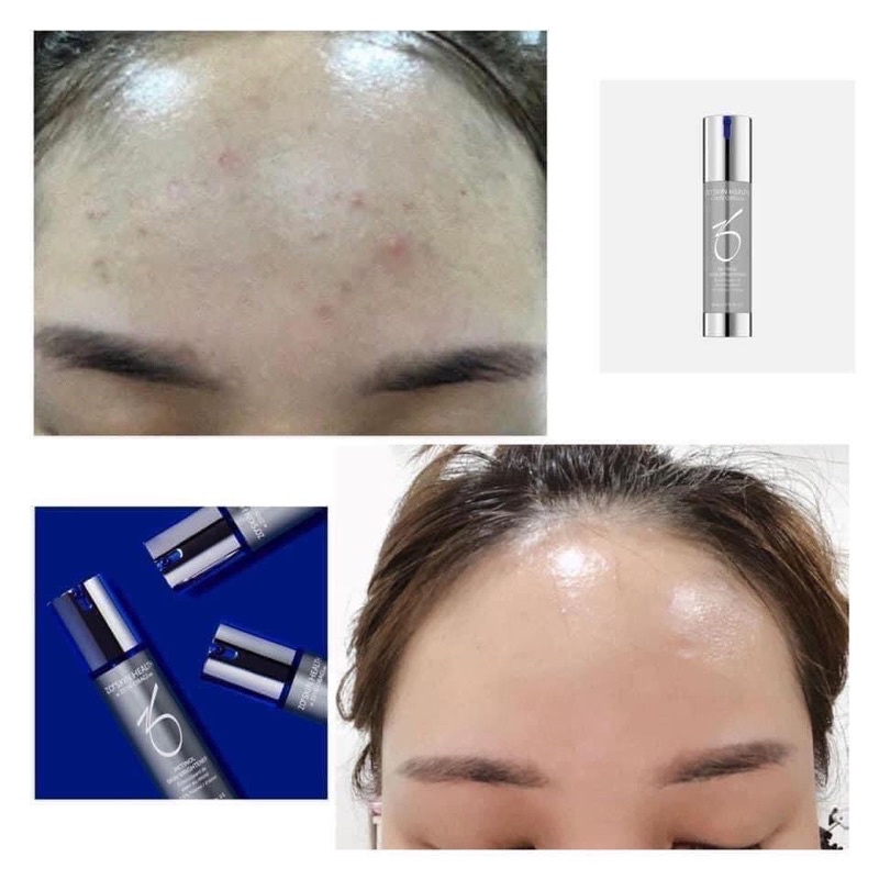 Kem chống lão hoá ZO Skin Brightener Retinol 50ml