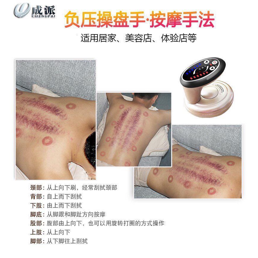 Máy cạo gió giác hơi điện