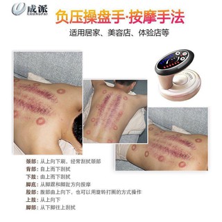 Máy cạo gió giác hơi điện