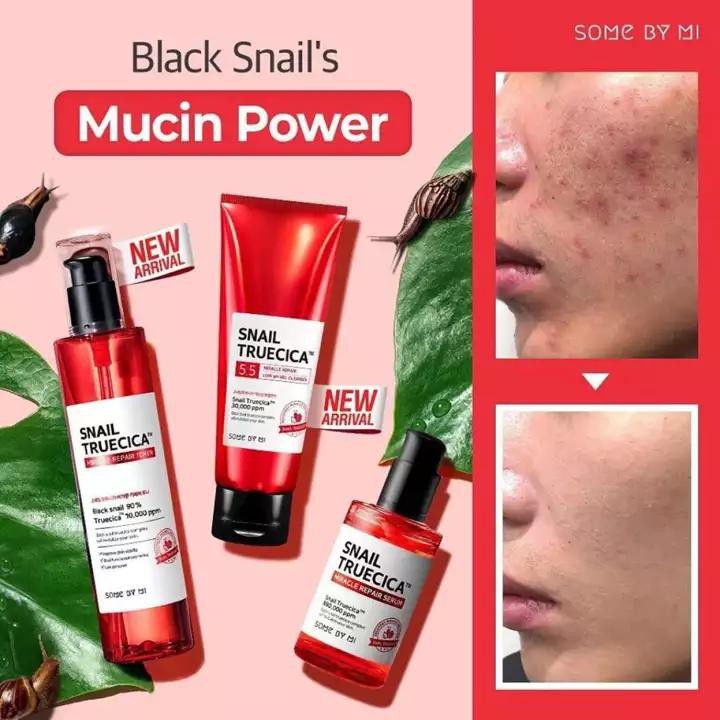 Bộ 4 Sản Phẩm Phục Hồi Mờ Thâm, Sẹo Some By Mi Snail Truecica Miracle Repair (SRM 100ml+Toner 135ml +SR 50ml + Kem 50ml)