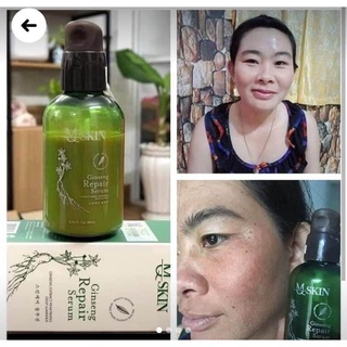 Serum thay da nhân sâm MQ Skin (chính hãng)