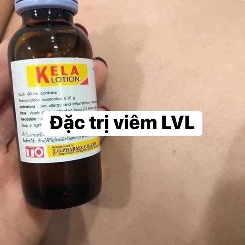 Kela lotion viêm nang lông chai 60ml nội địa thái