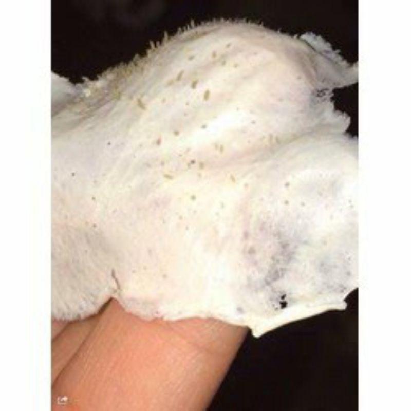 Gel hút mụn Peply nha đam lột sạch mụn siêu sạch 200gr