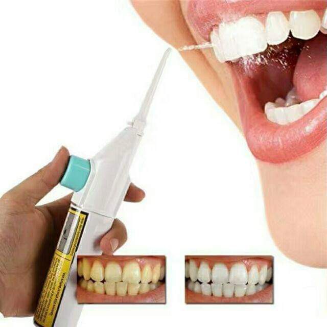 Dụng cụ xịt răng, vệ sinh răng ko cần dùng tăm (ảnh thật)