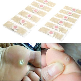 Miếng dán loại bỏ nốt chai sần và mụn cóc cho bàn chân