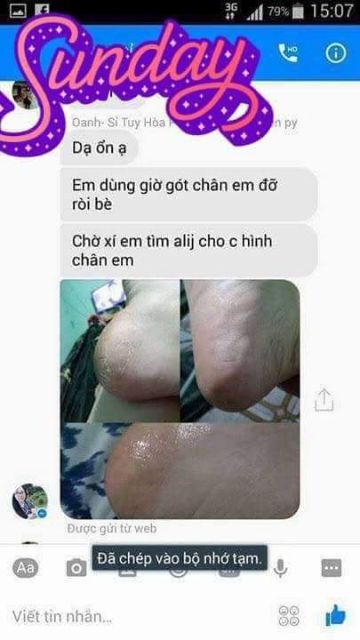 Mỡ trăn cao cấp trị nứt nẻ da và dưỡng da