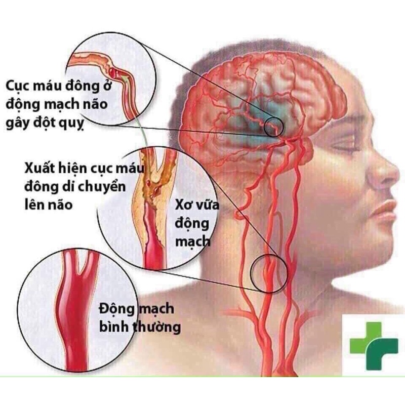 Đông Trùng Hạ Thảo 60 Viên Hộp Gỗ Vàng Hàn Quốc