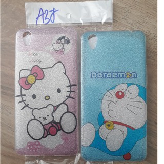 ỐP OPPO A37/ NEO 9 KIM TUYẾN IN HÌNH DỄ THƯƠNG