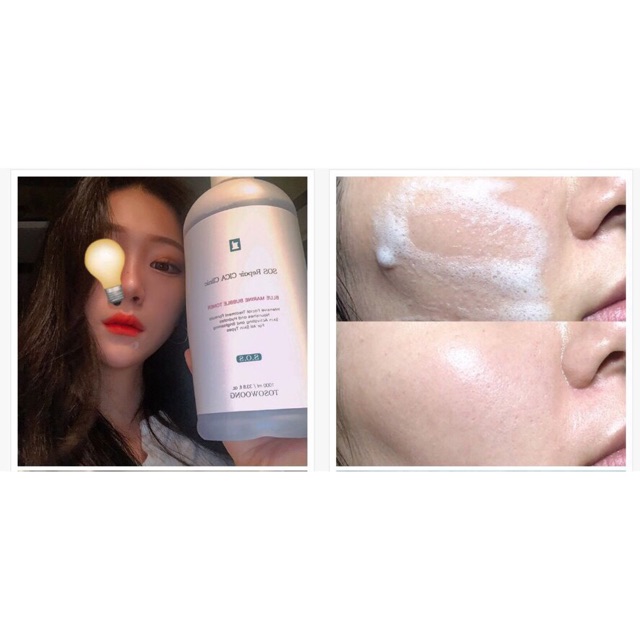 Nước hoa hồng phục hồi tosowoong toner tạo bọt bong bóng phục hồi da tosowoong - Chính hãng